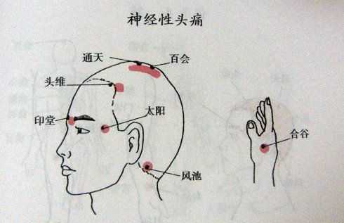 穴位按摩缓解头痛问题技巧